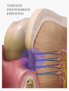 tubulos dentinarios